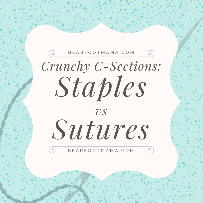 staples versus sutures