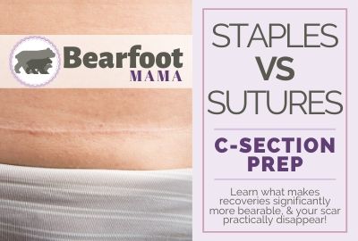 Can You Have a Natural, Vaginal Birth After A Caesarean Section? • Bearfoot  Mama